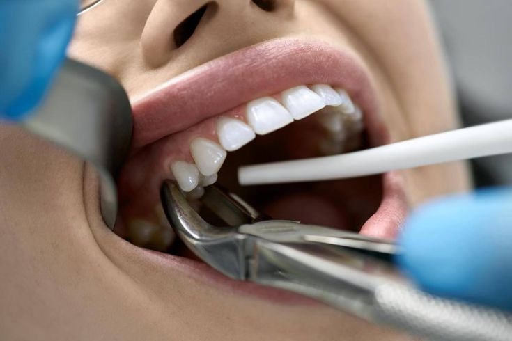 Oral Surgery Treatment In Madinaguda