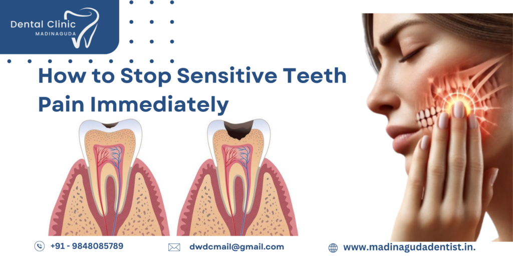 If you're wondering how to stop sensitive teeth pain immediately, you can try using special toothpaste made for sensitive teeth, rinse your mouth with warm salt water, and avoid very hot or cold foods. But if the pain doesn’t go away, it’s a good idea to visit your dentist to find out what’s causing the problem and get the right treatment.