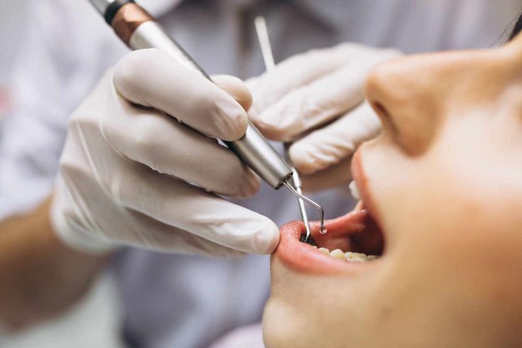 how to stop sensitive teeth pain immediately