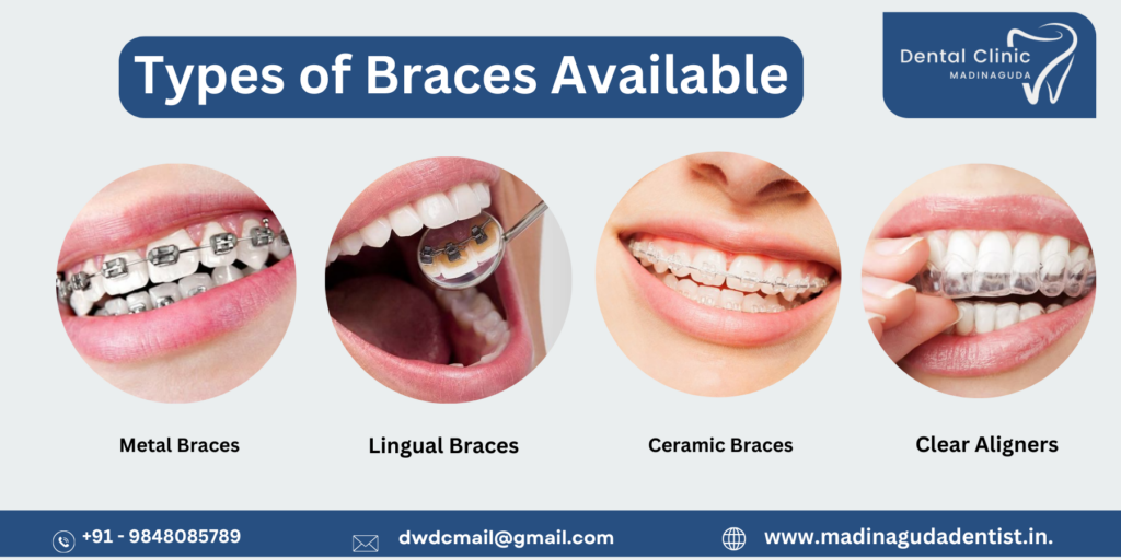 Teeth Braces Before and After