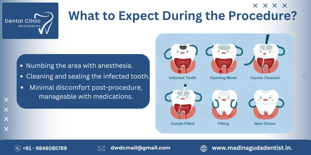 Root Canal Therapy Painful?