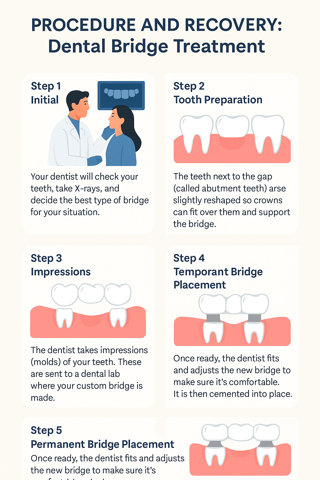 What is Dental Bridging