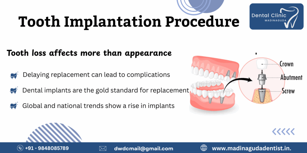 Tooth Implantation Procedure