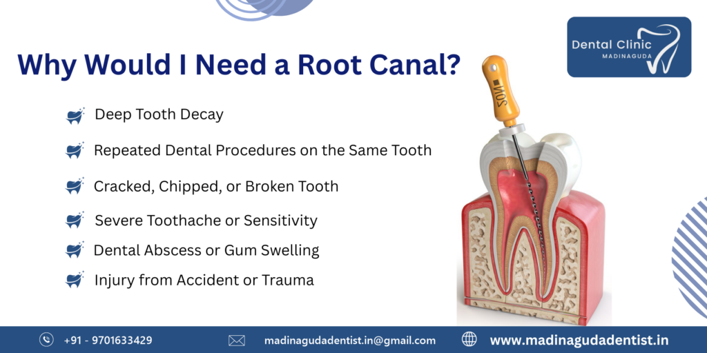 How to Stop Sensitive Teeth Pain Immediately (3)