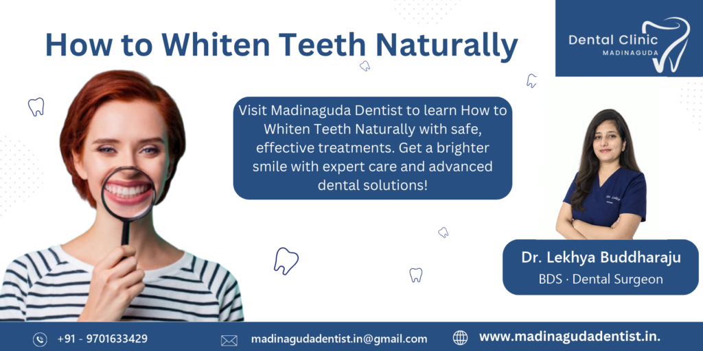How to Whiten Teeth Naturally